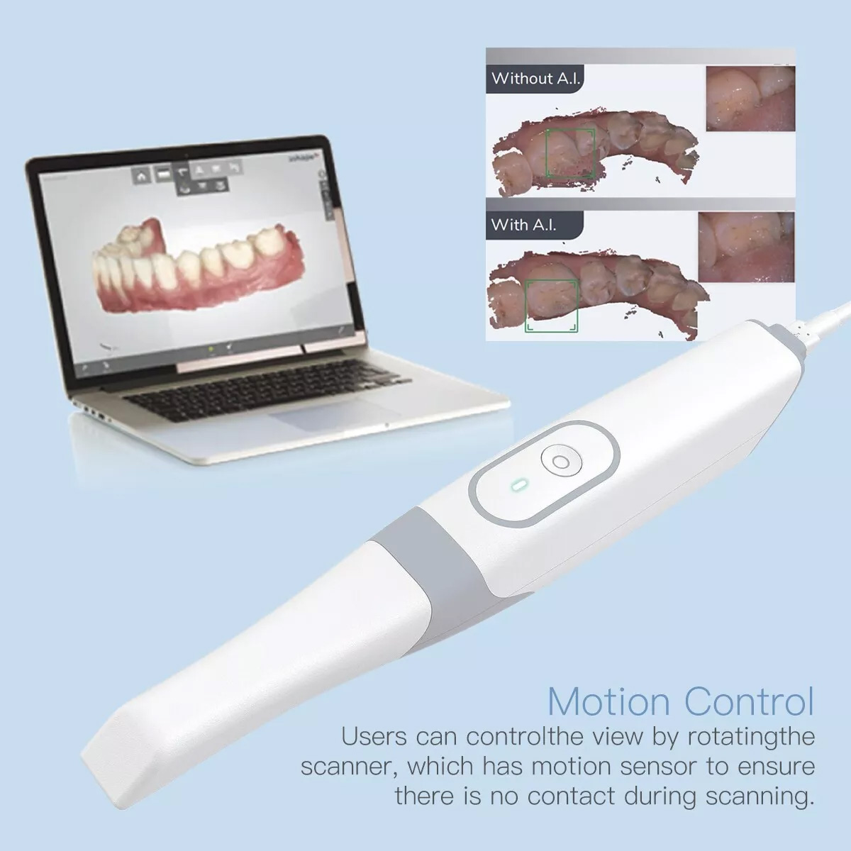 INO100 Dental Intraoral 3D Scanner Real Color 3D Dental Scanner with Software